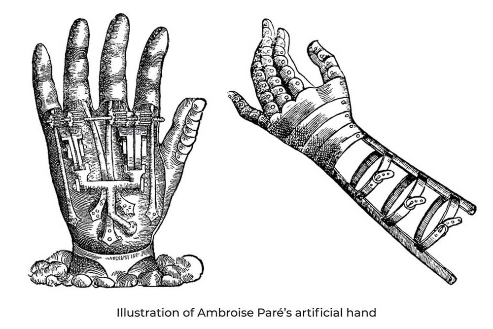 Inspired by a mechanical prosthetic hand invented by Ambroise Paré (1509-1590)